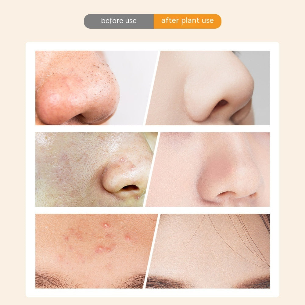 Visual Electric Blackhead Household Blackhead Removal Machine