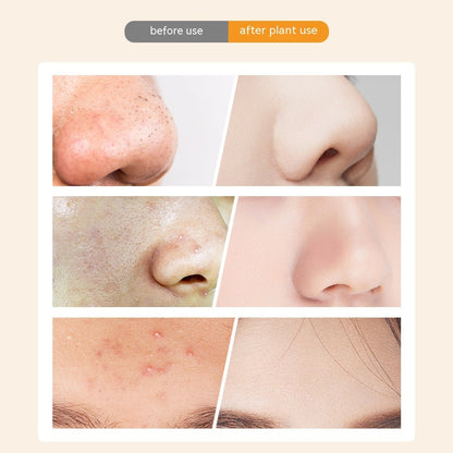 Visual Electric Blackhead Household Blackhead Removal Machine